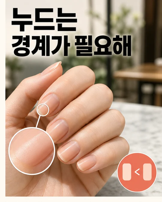2026 피치 누드 시럽 네일 손톱 경계, 8만원 결제했는데 야외 사진에서 손톱이 사라져 바로 다시 받고 싶다면 미미 공감 2컷